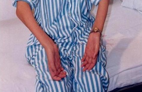 每天坚持吃一些，转氨酶降了脂肪肝也跑了「共享大医生」