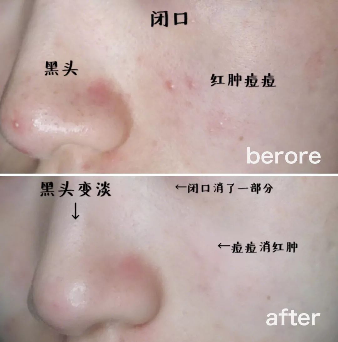 安瓶补水紧致提拉去皱精华,嫩白抗皱安瓶精华