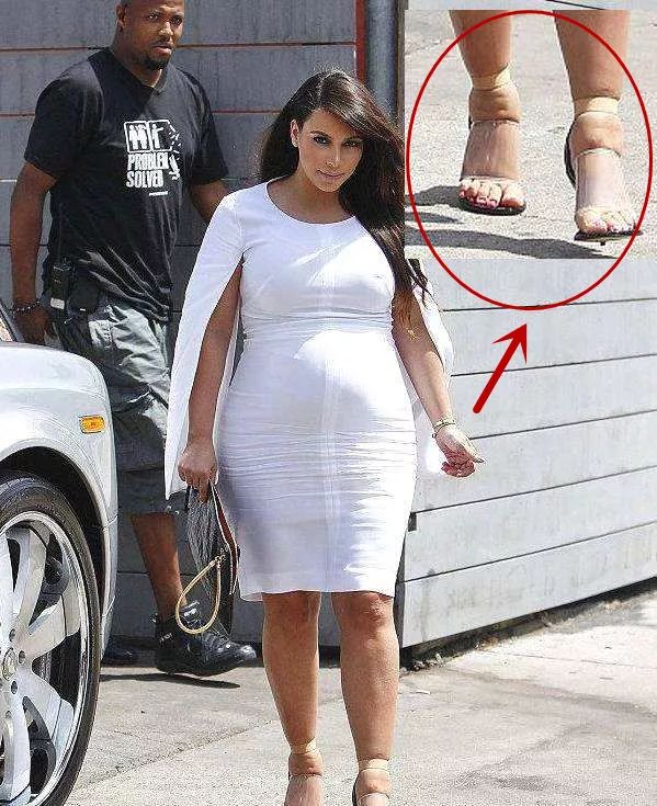 肩颈病用什么贴膏效果好,肩颈疼痛用日本什么膏药好