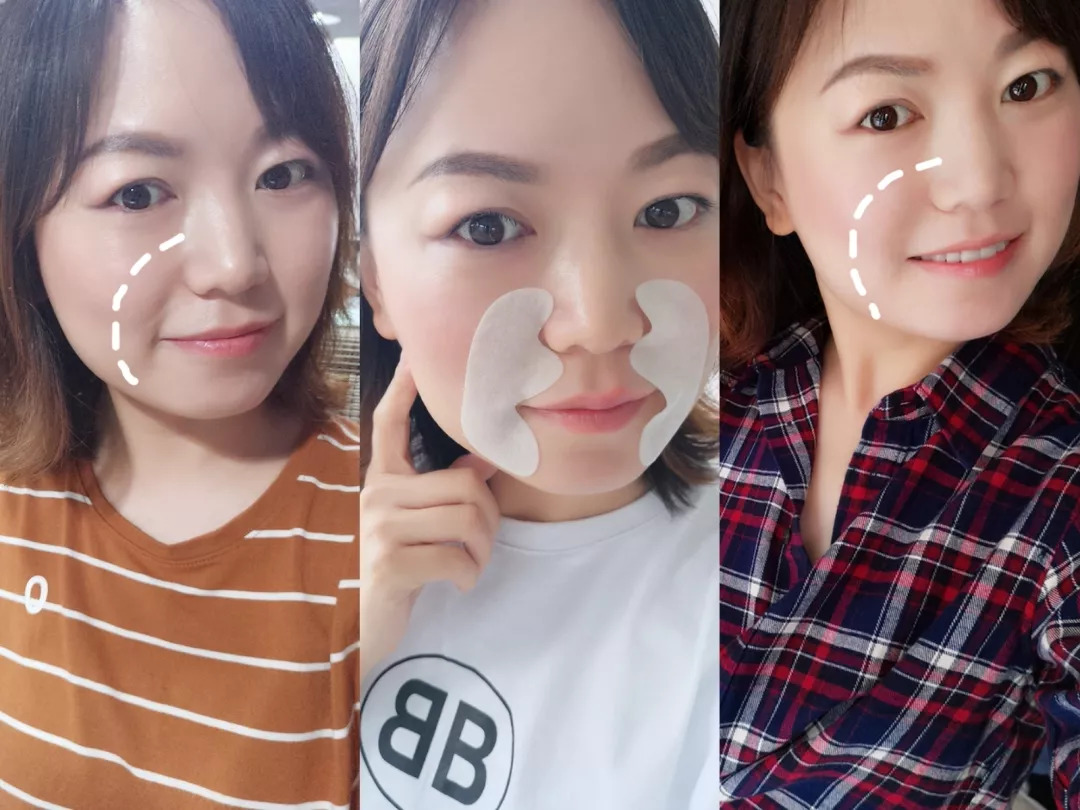 微晶法令纹贴抗皱纹提拉紧致面膜,淡纹抗皱法令纹面膜推荐