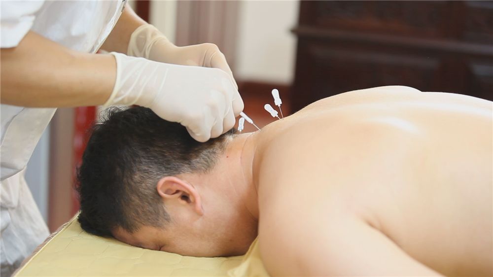 神奇的小针刀图片,神奇的小针刀是万能的吗