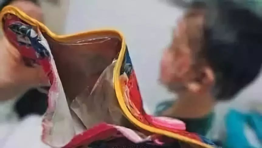 这东西已被禁8年，伤过很多人！几乎家家都有！