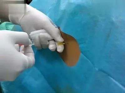 石家庄生二胎奖励政策最新消息,石家庄市关于生育二胎的有关政策