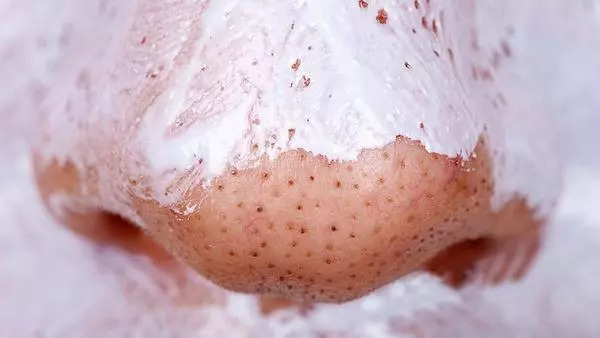 小米洁面仪真的好用吗,小米超声波洁面仪测评