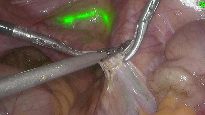 术中监测,术中监测仪