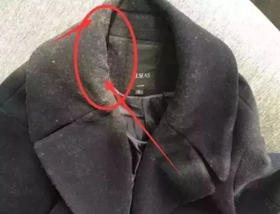 黑色纯棉衣服粘毛妙招,衣服粘毛絮用啥方法