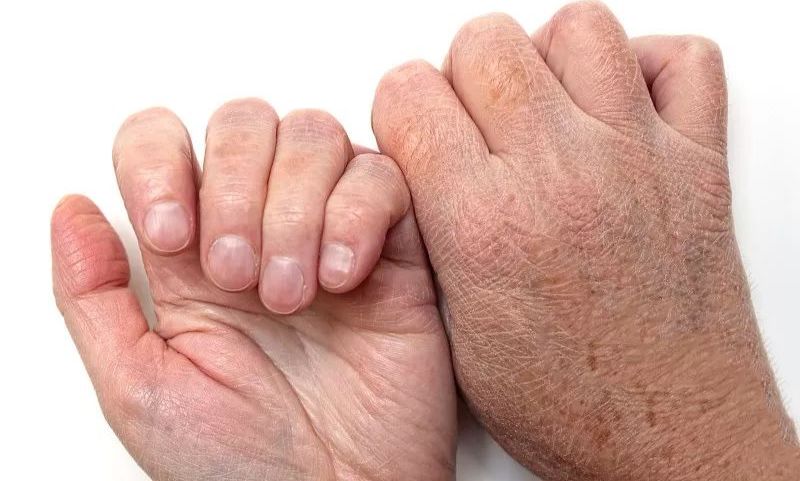 冬季如何拯救你的“主妇手”？