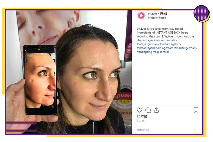 一分钟提拉紧致去除眼袋皱纹,修眼袋祛皱纹神器