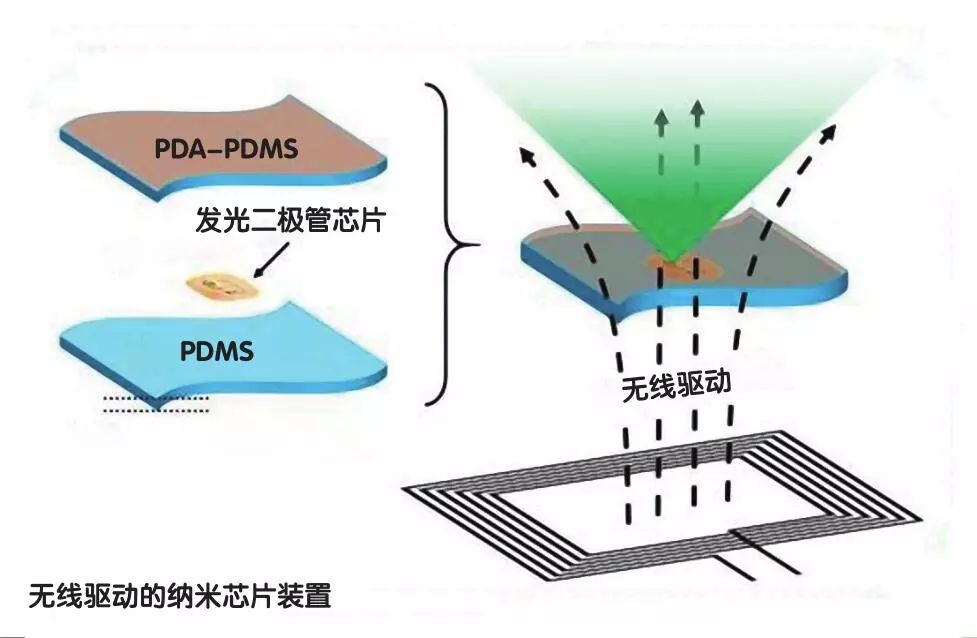 光动力可以杀死hpv吗,光动力治疗能杀死肺癌肿瘤吗
