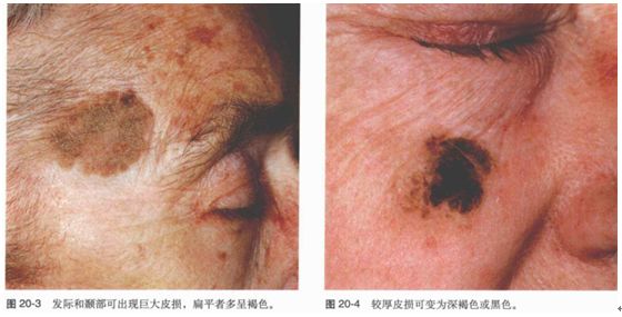 你说不“痣”道的事！