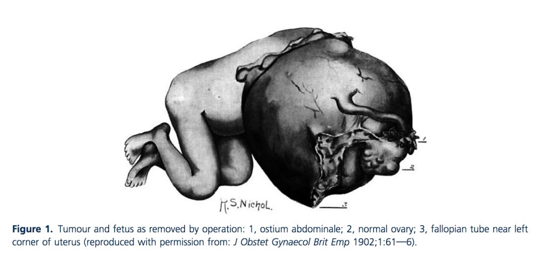 聊聊怀孕这些事,怀孕这件大事儿