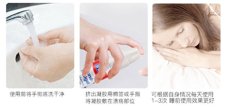 口腔溃疡反复发作吃什么容易愈合,口腔溃疡一抹止痛