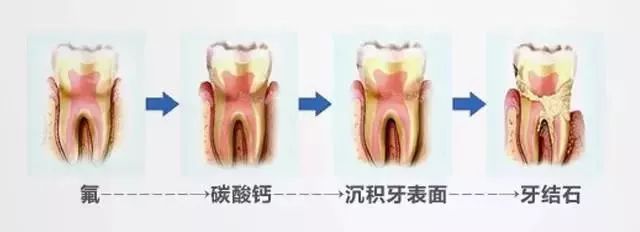 抗牙敏感强的牙膏,澳洲牙膏排行榜前十名