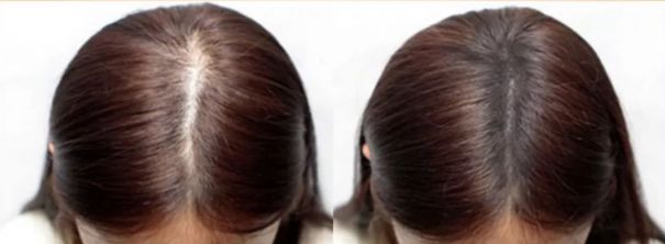 额前长小碎发,额前小碎发往后长