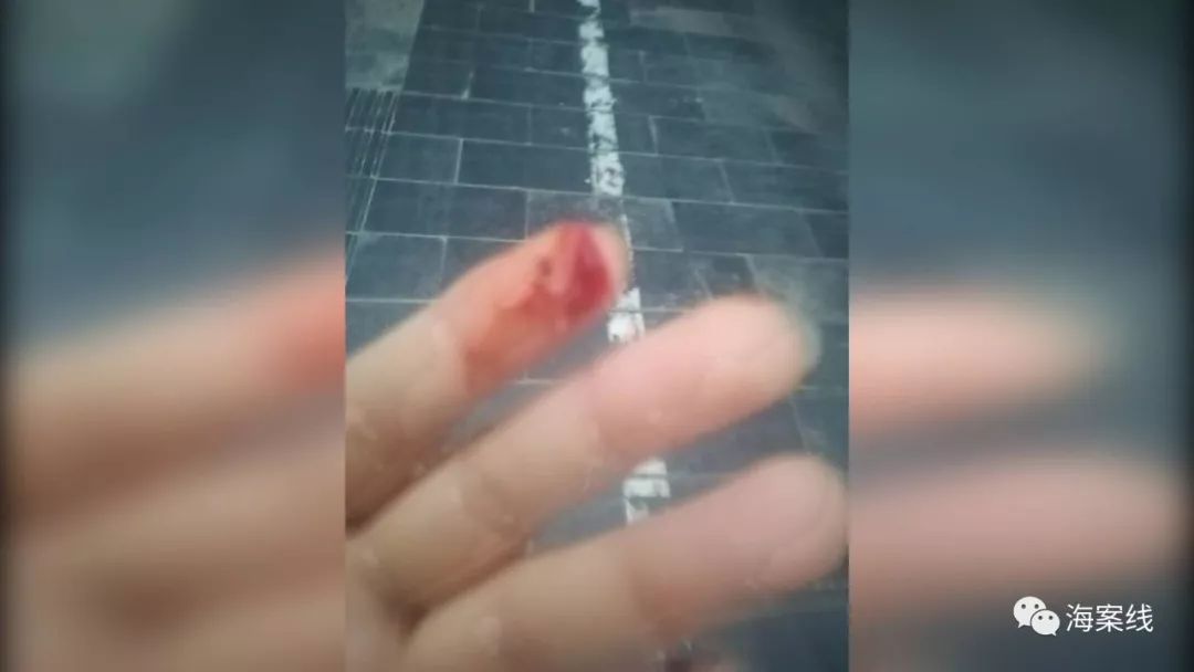 网购衣服质量问题但是洗过了,网购衣物质量太差