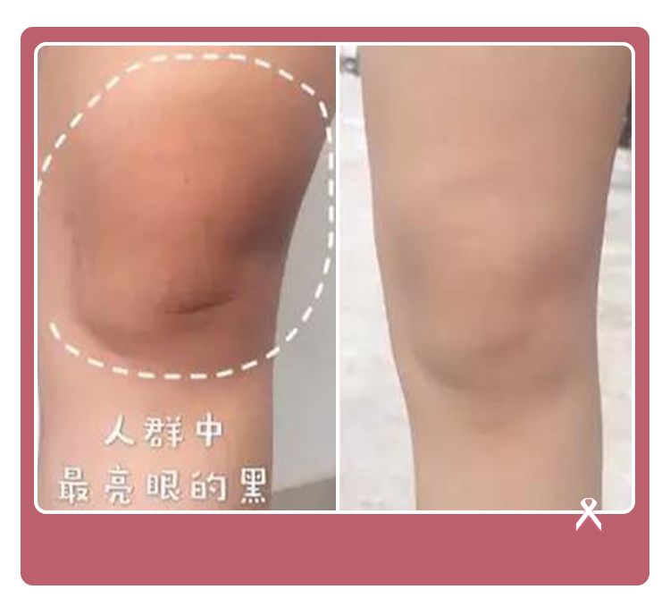 精致从头到脚,细节展现气质,一块嫩红皂让你6周变粉嫩少女!