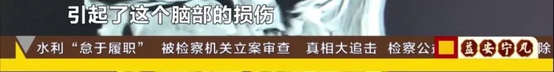 湖南一男子莫名全身乏力口齿不清，脑子里还有蠕动的……都是因为18年前吃了这个