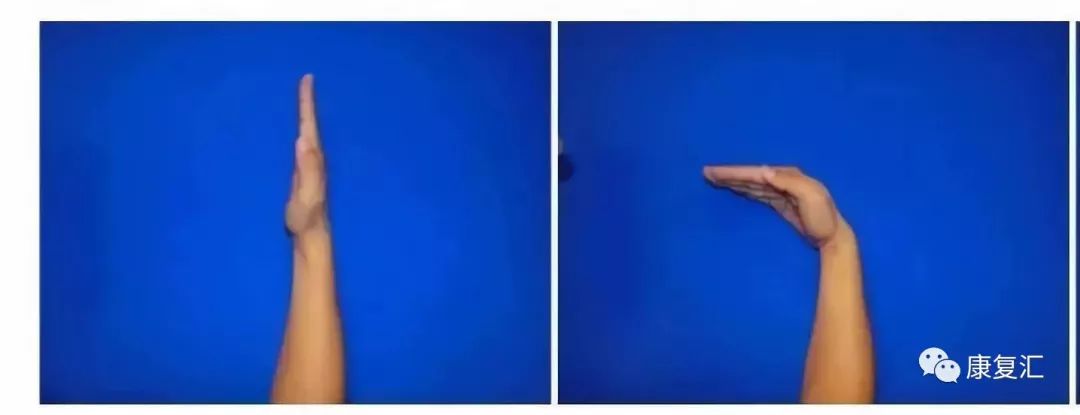 手指麻木刺痛,手指手术后麻木康复训练法