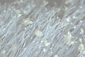 头上头皮屑和剪发虫怎么解决,头皮屑多和肚子里有虫有关系吗