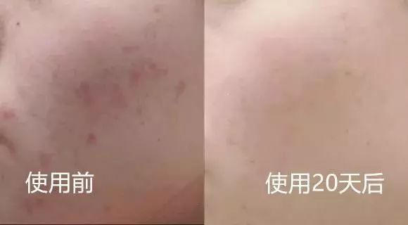 毛孔粗大清洁测评,暗沉粗糙毛孔粗大测评