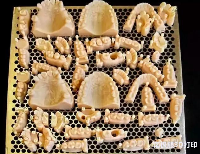 牙医牙齿3d打印技术,3d打印治疗牙齿的最新技术