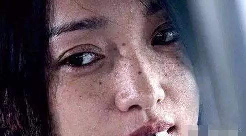 如何改善色斑暗沉问题,面色暗沉色斑多如何改善