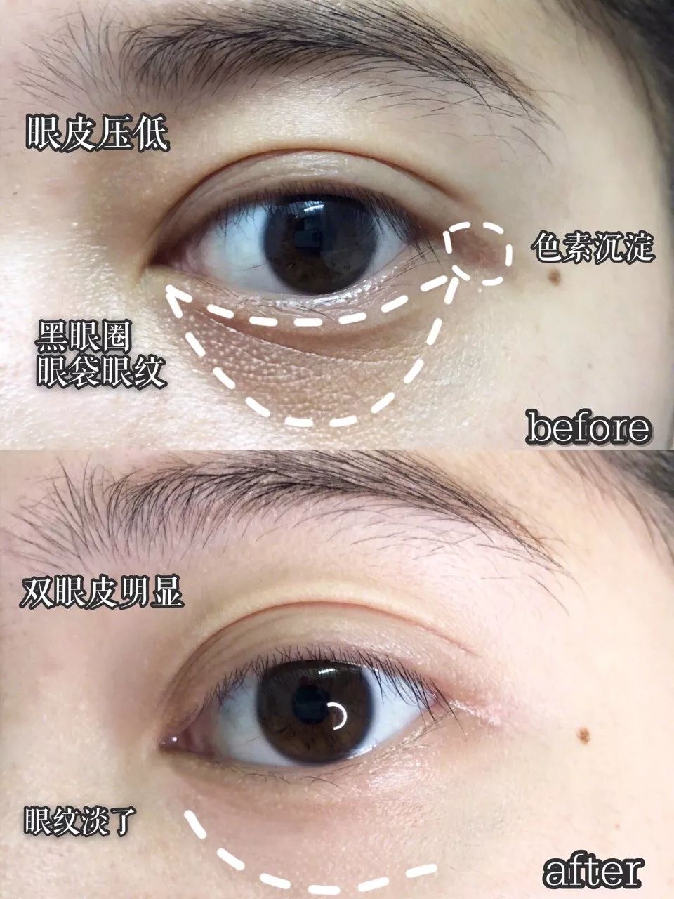 韩国牌子眼霜抗老去皱保湿,平价好用的韩国化妆品牌