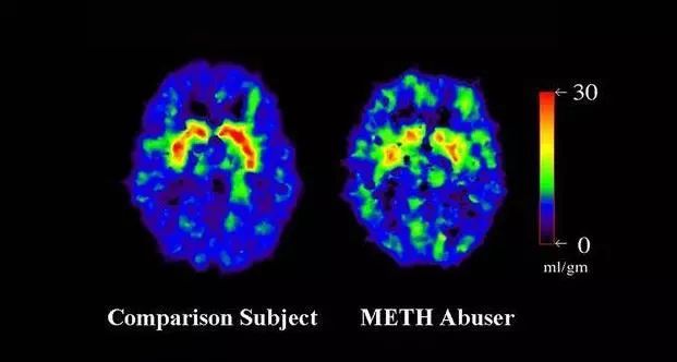 *毒冰**是如何从军需药品发展成为新一代*品毒**之王的