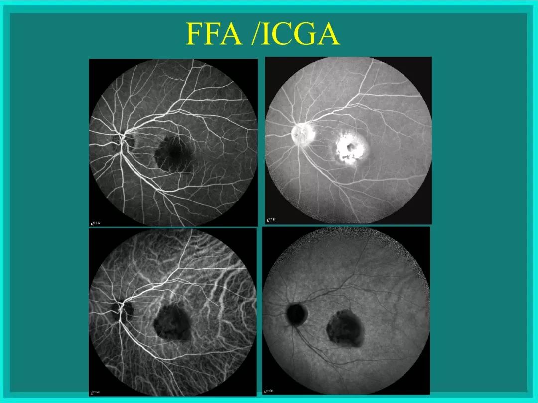 明者远见于未萌原文,明者远见于未萌解释