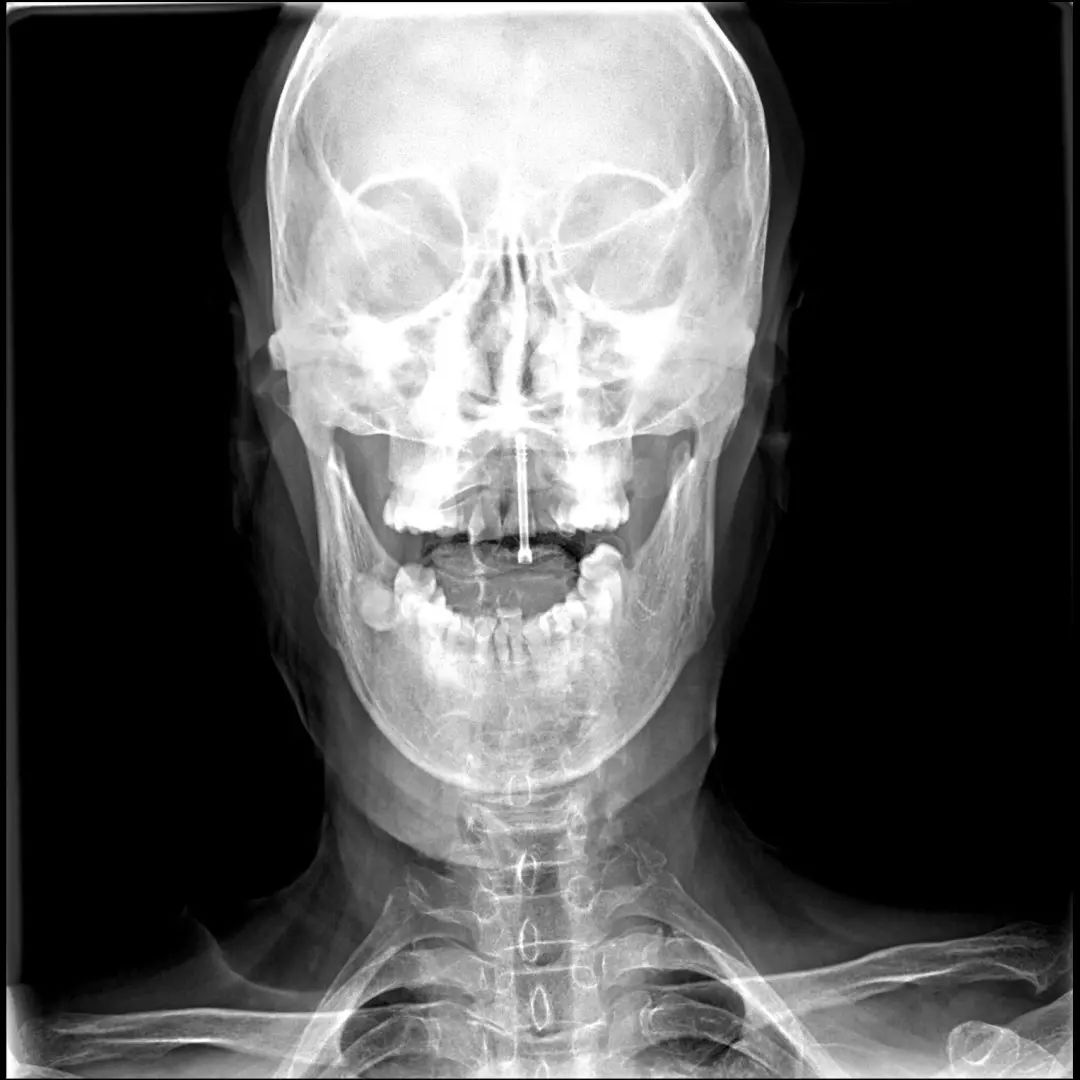 鍕囬棷鐢熷懡绂佸尯鍖婚櫌,鍕囬棷鐢熷懡绂佸尯浜旀鍙仠鎵嬫湳