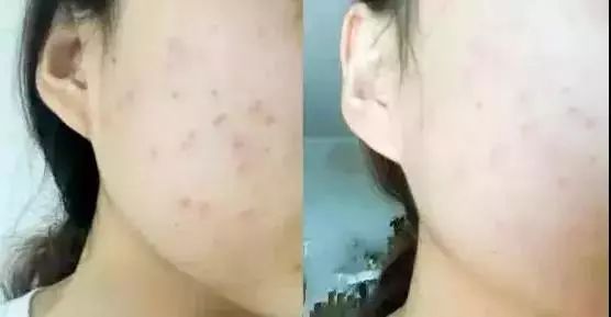 让肌肤重获新生,活肤水排行榜10强抗衰老