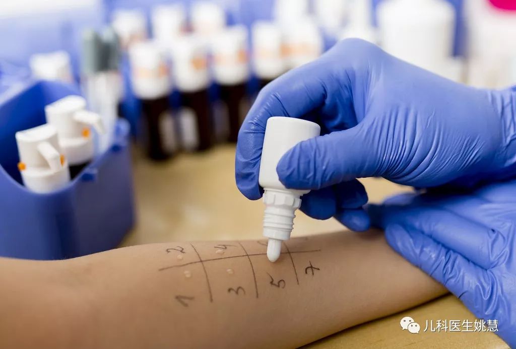 皮肤点刺实验检测哪些过敏源,过敏原皮肤点刺试验杭州