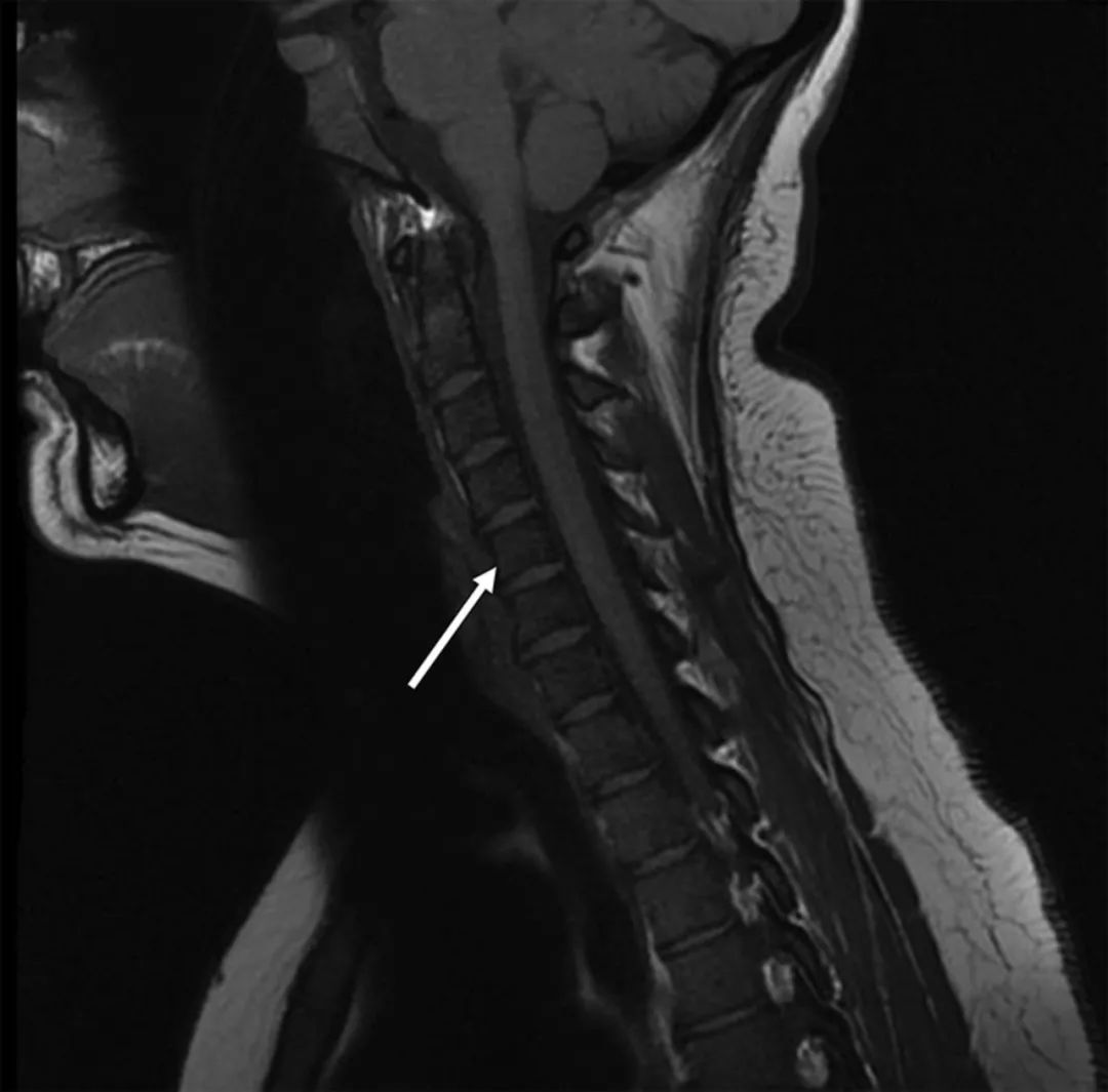 下巴发麻做什么检查,下巴麻木去医院挂什么科