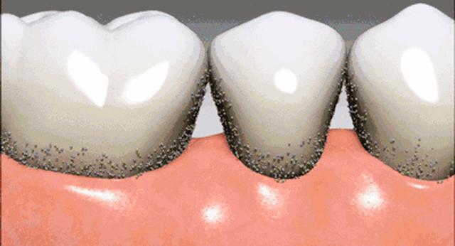 公认去牙黄最好的牙膏老爸评测,去牙渍去口气的牙膏测评