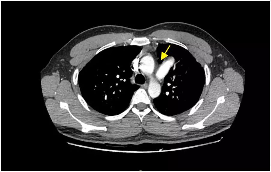 心动在线怎么没有了,心动在线观看