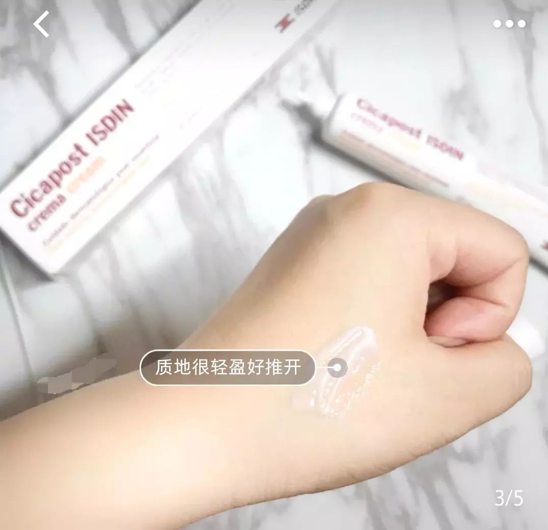 疤痕体质如何去痘印和烫伤印,烫伤色素疤痕修复的最新方法