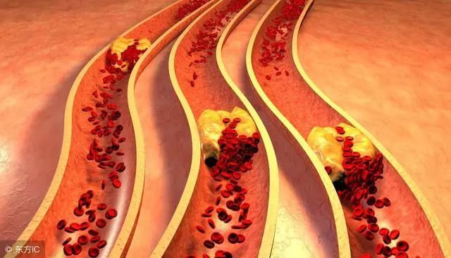 急性心肌梗死院前急救的急救措施,中医治疗急性心肌梗死的急救方法