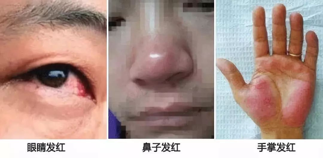 小心肝护肝茶有用吗,小心肝茶叶是什么茶