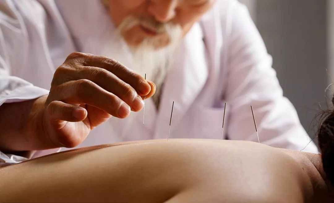 小孩近视中医怎么调理,中医穴位调理近视