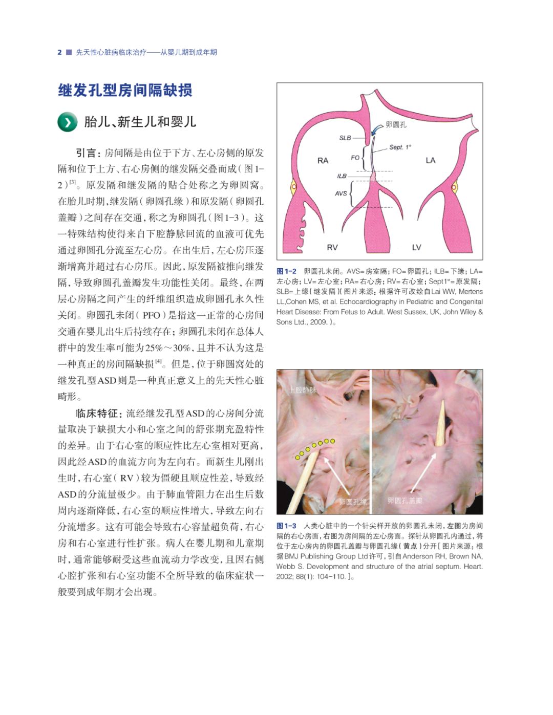 如何诊治先天性心脏病？看美国专家如是说