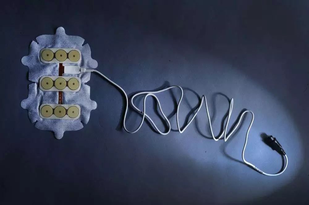 5年生存率翻番!这种全球范围内首次获批的电场抗癌黑科技,是脑部肿瘤治疗领域近10年来最大的突破丨奇点搜神记