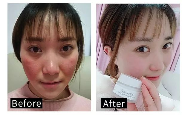 抗氧化修护面霜,修复维稳抗老大牌精华和面霜