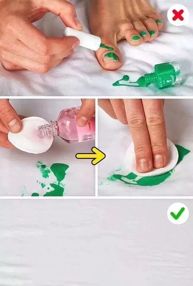 衣服发黄只能扔掉?太浪费!这么洗,每天都穿新衣服