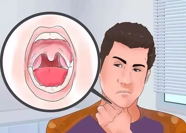 半夜睡醒嘴里发苦发臭怎么解决,夜里睡觉嘴里发干发苦吃什么药