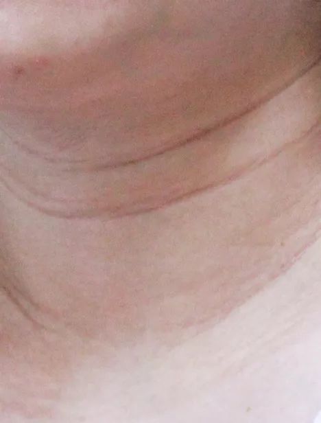 姑娘我看你印堂发黑下一句,姑娘我看你印堂发黑下一句是什么