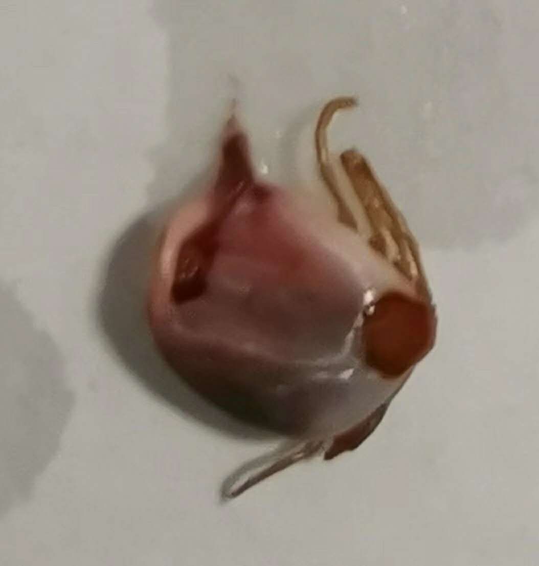 小孩被吓到头上点红点怎么回事,儿童头顶痒拔掉好多头发是什么病