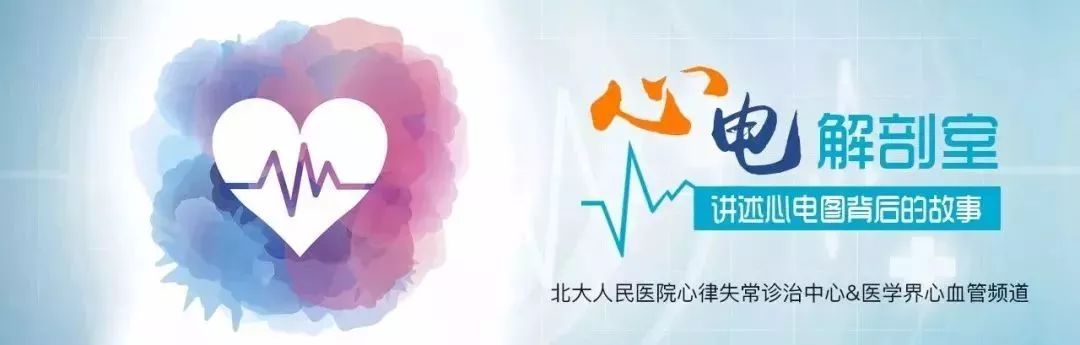 心电图显示窦性心动过速怎么办,一张心电图可以诊断心脏过缓吗