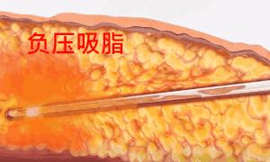 不用节食也可以暴瘦身体,不用节食还能瘦的神器