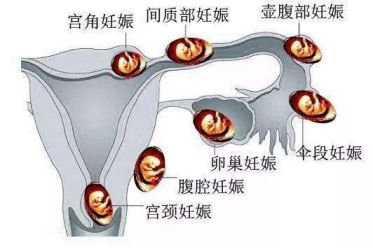 hcg值能判断胎心胎芽吗,hcg值能判断怀孕吗