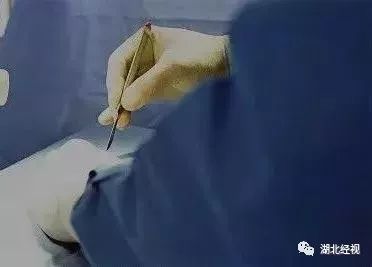 假扮医生给男生手术,假医生给人开刀手术